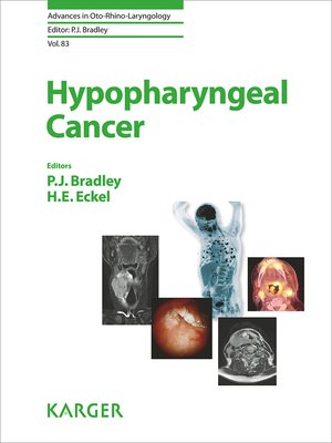 cover image of Hypopharyngeal Cancer